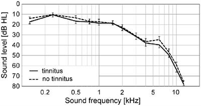 Speech Comprehension and Its Relation to Other Auditory Parameters in Elderly Patients With Tinnitus